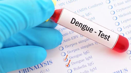 Maximum charge set for dengue tests