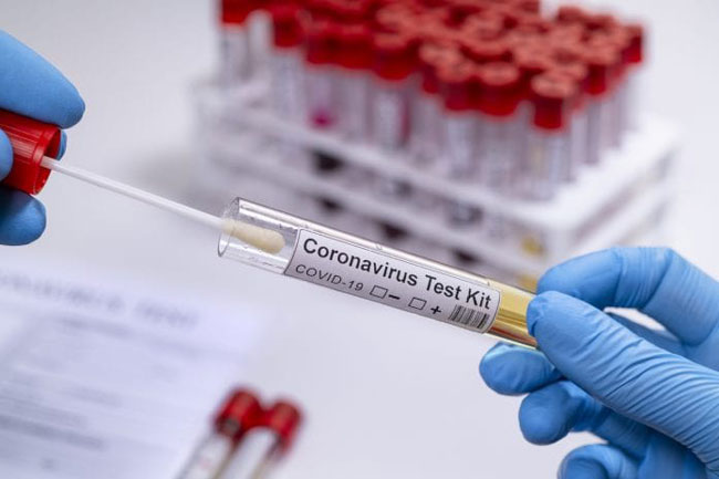 Three including foreigner test positive as Covid-19 tally hits 2,814