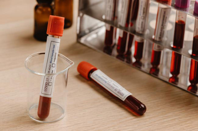 More arrivals from Oman test positive for coronavirus