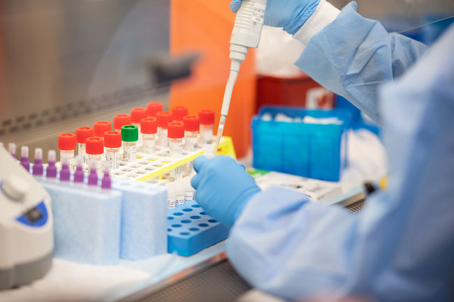 Over 205,000 PCR tests carried out in Sri Lanka