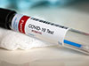 Two more Covid-19 cases moves total to 2,986