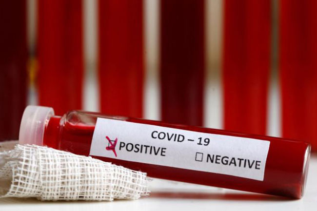 More foreign arrivals test positive for COVID-19