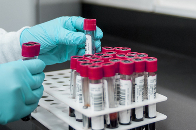 Ten arrivals positive for COVID-19; total cases at 4,252