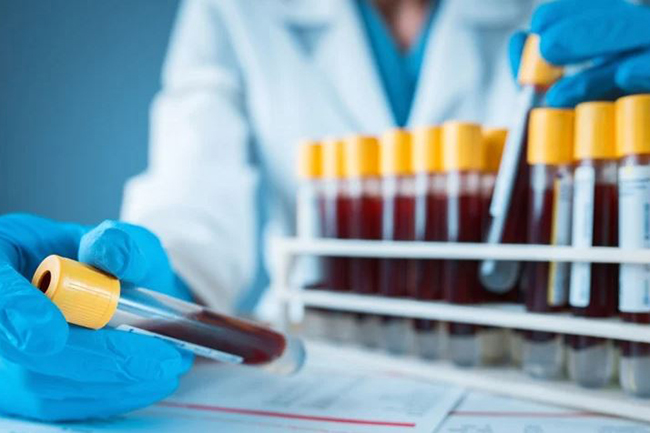 Sri Lankas Covid-19 figures hike with 88 fresh cases