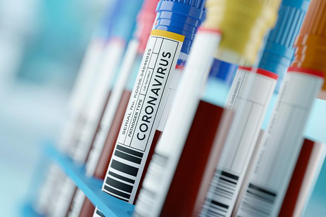 Coronavirus: 198 fresh cases confirmed