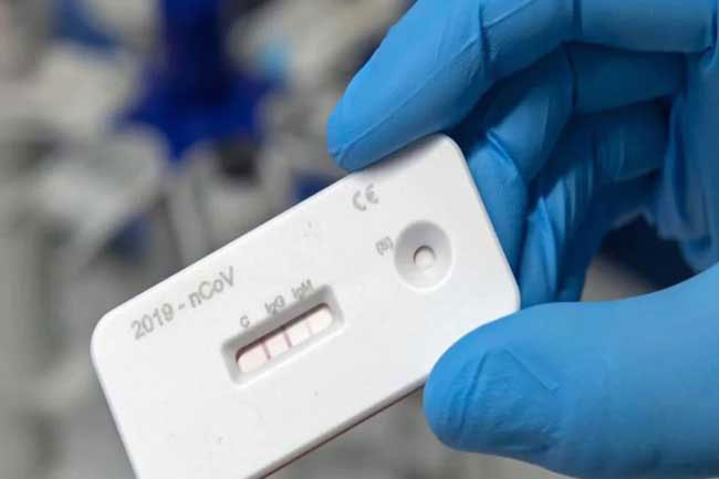 COVID-19 Rapid Antigen Test Kits distributed to major govt hospitals