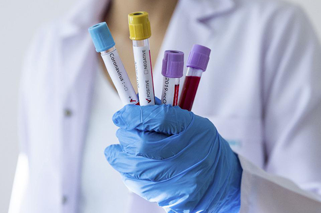 Coronavirus: Sri Lanka registers 260 new infections