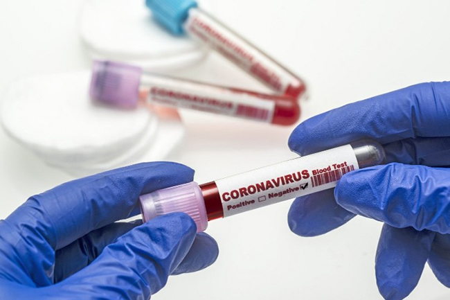 Sri Lanka confirmed over 39,000 COVID-19 recoveries so far