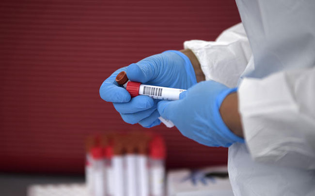952 coronavirus cases reported in Sri Lanka today