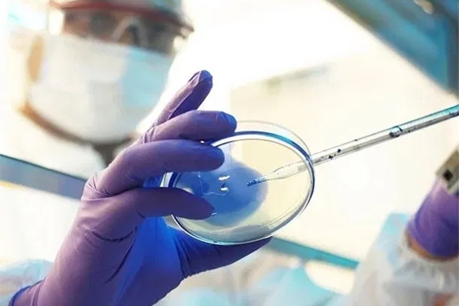 Black fungus case not detected in Sri Lanka, experts confirm