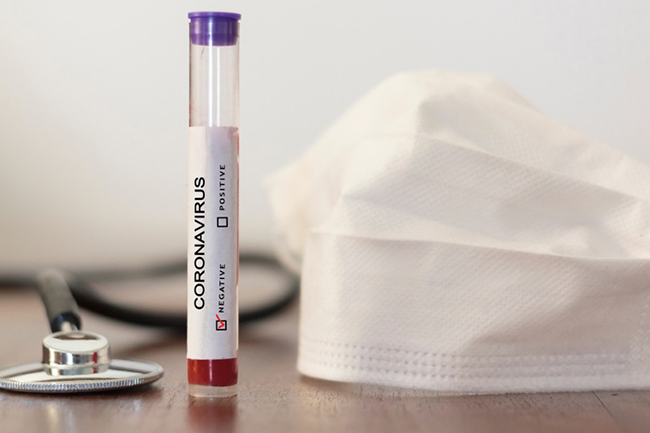 Sri Lanka reports 1,717 more coronavirus recoveries