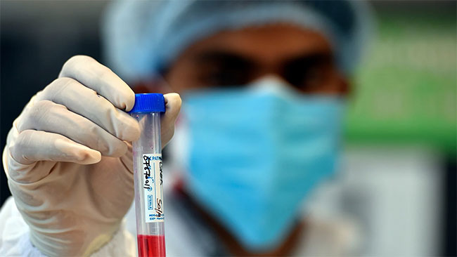 Coronavirus: 580 fresh cases reported in Sri Lanka