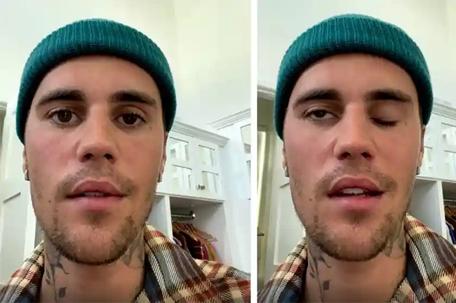 Justin Bieber reveals facial paralysis after shows cancelled