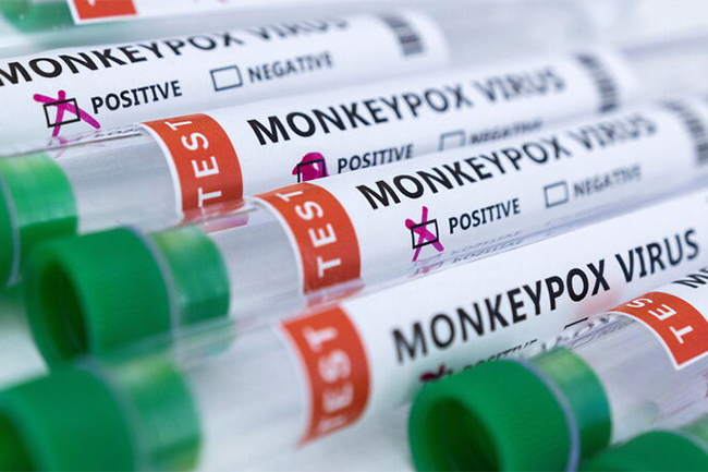 Spain reports first monkeypox-related death in Europe