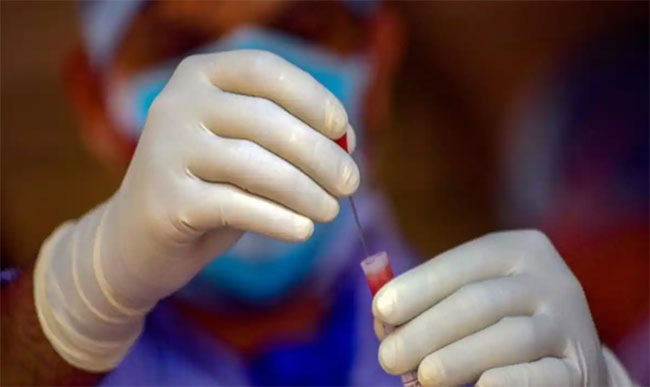 Covid-19: four more deaths and 49 new cases reported
