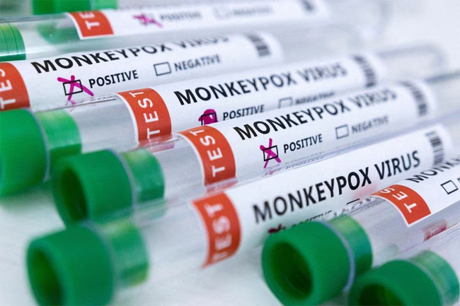 Public urged not to have undue fears about monkeypox infection