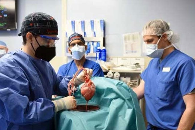 US experts carry out second pig-to-human heart transplant