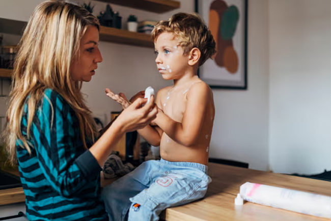 Surge in measles cases prompts UK to declare national health incident