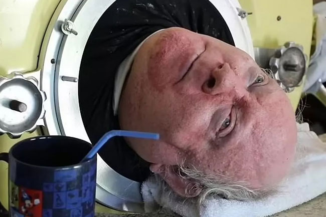 Texas man who lived seven decades in iron lung dies at age 78