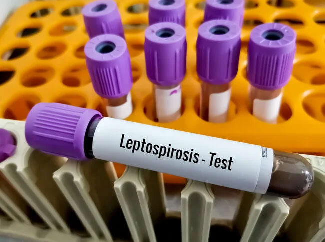 Ratnapura District records highest leptospirosis deaths and infections in 2024