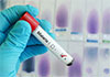 First malaria treatment for babies approved for use