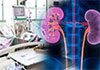 Five people at risk of dying daily due to chronic kidney disease in Sri Lanka