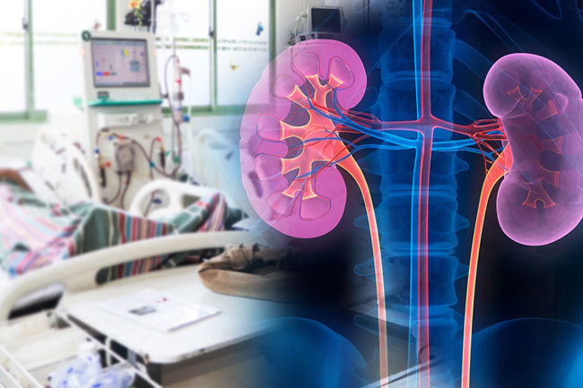 Five people at risk of dying daily due to chronic kidney disease in Sri Lanka