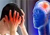 One in every four people over the age of 25 may experience stroke - health experts