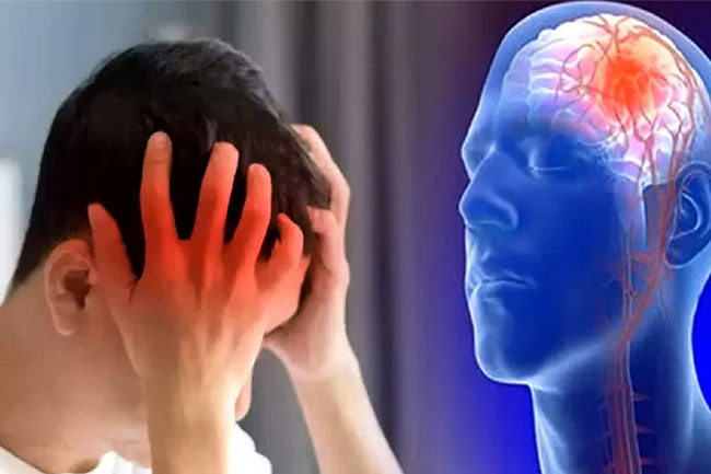 One in every four people over the age of 25 may experience stroke - health experts