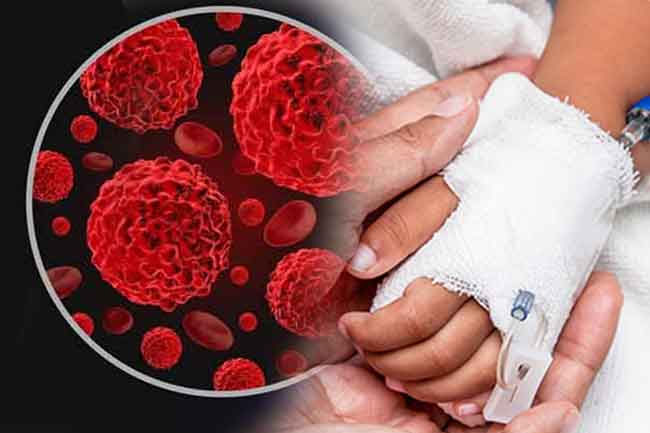 Around 250 children die daily from cancer worldwide