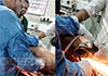 Badulla hospital staff save man after iron rod pierces through body