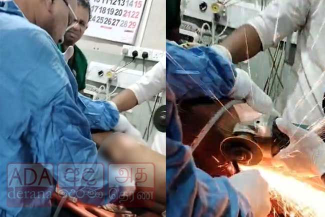 Badulla hospital staff save man after iron rod pierces through body