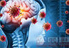 237 suspected meningitis cases reported across Sri Lanka