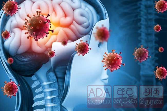 237 suspected meningitis cases reported across Sri Lanka
